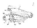 Fig. 01 - Releasable blocking system of a catheter