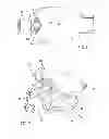 Fig. 06 - Releasable blocking system of a catheter