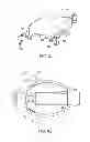 Fig. 09 - Releasable blocking system of a catheter