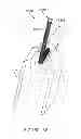 Fig. 32 - SHARPS PROTECTOR DEVICE FOR PROTECTING A USER FROM A SHARP TIP OF A MEDICAL NEEDLE