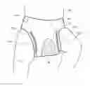 Fig. 01 - Phototherapy Diaper