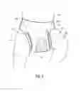 Fig. 06 - Phototherapy Diaper