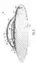 Fig. 02 - Drug-delivery pump with dynamic, adaptive control