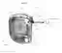 Fig. 06 - Apparatus, systems and methods for the treatment of neurological conditions