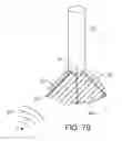 Fig. 12 - Apparatus, systems and methods for the treatment of neurological conditions