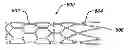 Fig. 01 - Bioabsorbable Spacers and Spacer Delivery Systems for Use in the Ear, Nose and Throat