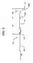 Fig. 06 - Bioabsorbable Spacers and Spacer Delivery Systems for Use in the Ear, Nose and Throat