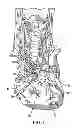 Fig. 02 - Methods and systems for treating acute heart failure by neuromodulation