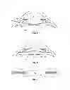 Fig. 04 - Methods and systems for performing a posterior capsulotomy and for laser eye surgery with a penetrated cornea