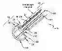 Fig. 01 - Method for Reducing the Absorption of Nutrients Through the Gastrointestinal Tract