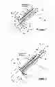 Fig. 02 - Method for Reducing the Absorption of Nutrients Through the Gastrointestinal Tract