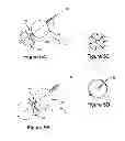 Fig. 05 - Method for Reducing the Absorption of Nutrients Through the Gastrointestinal Tract