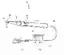Fig. 01 - System and method of controlling power delivery to a surgical instrument