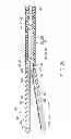 Fig. 04 - Treatment device