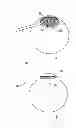 Fig. 01 - Circular thermal capsulotomy tool and system