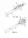 Fig. 08 - Circular thermal capsulotomy tool and system