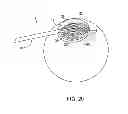 Fig. 22 - Circular thermal capsulotomy tool and system