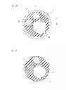 Fig. 03 - CATHETER