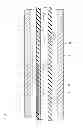 Fig. 04 - CATHETER