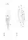 Fig. 05 - CATHETER