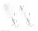 Fig. 05 - Straight intramedullary fracture fixation devices and methods