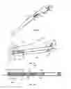 Fig. 11 - Straight intramedullary fracture fixation devices and methods