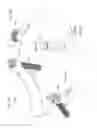 Fig. 25 - Straight intramedullary fracture fixation devices and methods