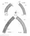 Fig. 26 - Straight intramedullary fracture fixation devices and methods