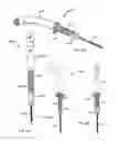 Fig. 32 - Straight intramedullary fracture fixation devices and methods