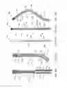 Fig. 56 - Straight intramedullary fracture fixation devices and methods