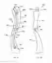 Fig. 58 - Straight intramedullary fracture fixation devices and methods