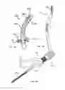 Fig. 59 - Straight intramedullary fracture fixation devices and methods