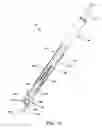 Fig. 12 - Method and apparatus for performing arthroscopic microfracture surgery