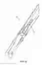 Fig. 15 - Method and apparatus for performing arthroscopic microfracture surgery