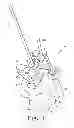 Fig. 02 - Humeral rotating burr guide