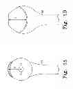 Fig. 06 - Humeral rotating burr guide