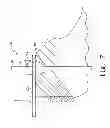 Fig. 09 - Humeral rotating burr guide