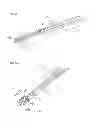 Fig. 02 - DEFLECTABLE TISSUE DISRUPTION DEVICE