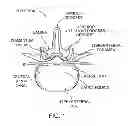 Fig. 02 - Flexible tissue removal devices and methods