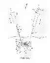 Fig. 03 - Flexible tissue removal devices and methods