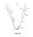 Fig. 06 - Flexible tissue removal devices and methods
