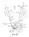 Fig. 19 - Flexible tissue removal devices and methods