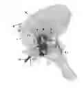 Fig. 01 - SURGICAL GUIDES AND METHODS FOR MANUFACTURING THEREOF