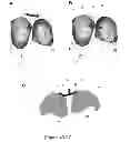 Fig. 02 - SURGICAL GUIDES AND METHODS FOR MANUFACTURING THEREOF
