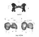 Fig. 04 - SURGICAL GUIDES AND METHODS FOR MANUFACTURING THEREOF