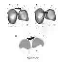 Fig. 05 - SURGICAL GUIDES AND METHODS FOR MANUFACTURING THEREOF