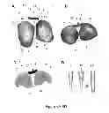 Fig. 06 - SURGICAL GUIDES AND METHODS FOR MANUFACTURING THEREOF