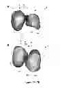 Fig. 07 - SURGICAL GUIDES AND METHODS FOR MANUFACTURING THEREOF