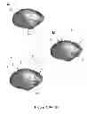 Fig. 10 - SURGICAL GUIDES AND METHODS FOR MANUFACTURING THEREOF