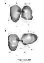 Fig. 11 - SURGICAL GUIDES AND METHODS FOR MANUFACTURING THEREOF